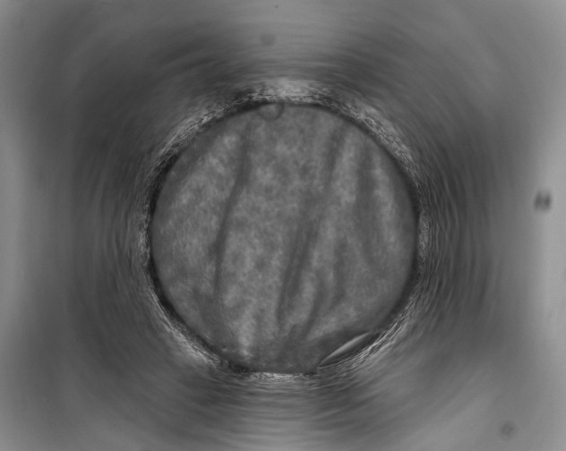 X0000098170449200805151120