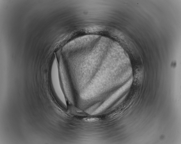 X0000098170452200805151120