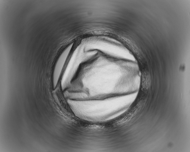 X0000098170453200805151120