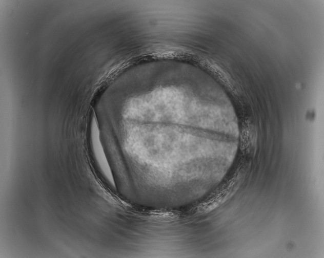 X0000098170454200805151120