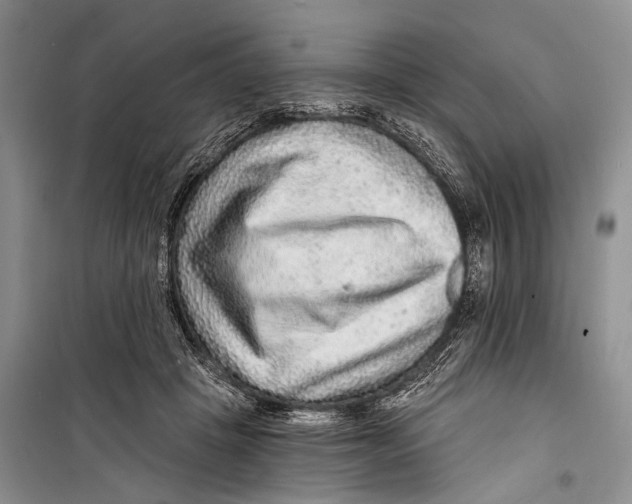 X0000098170457200805151121