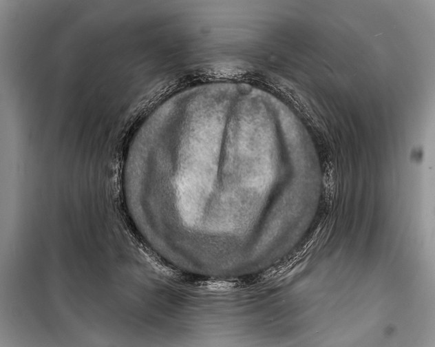 X0000098170462200805151121