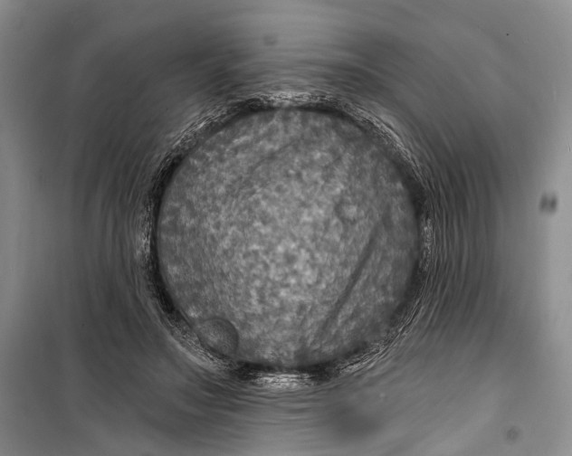 X0000098170499200805151120