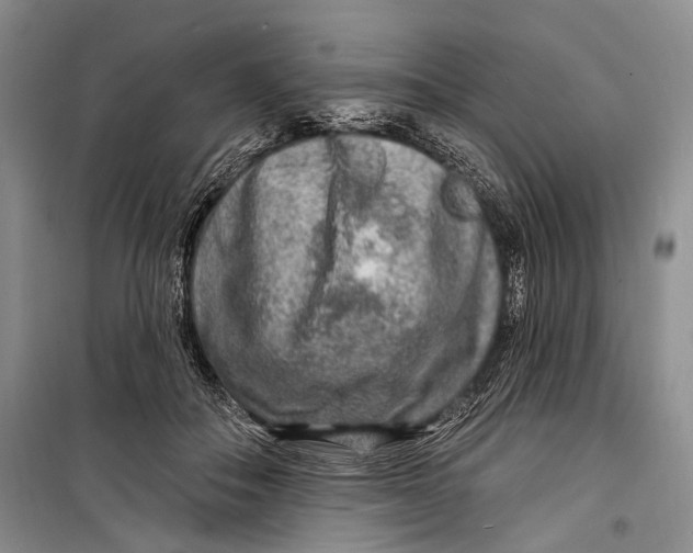 X0000098170506200805151120