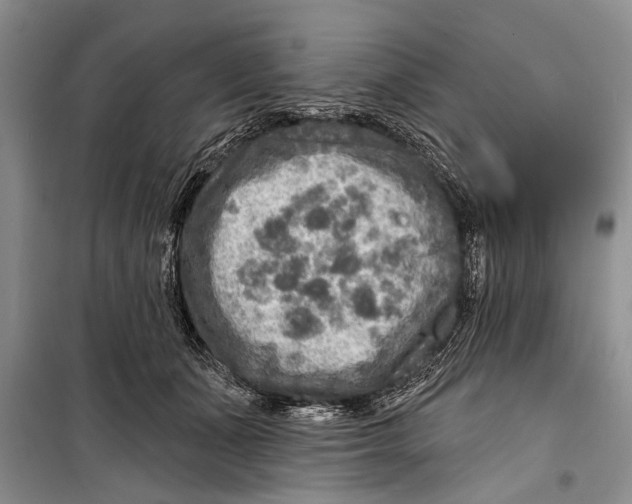 X0000098170511200805151120