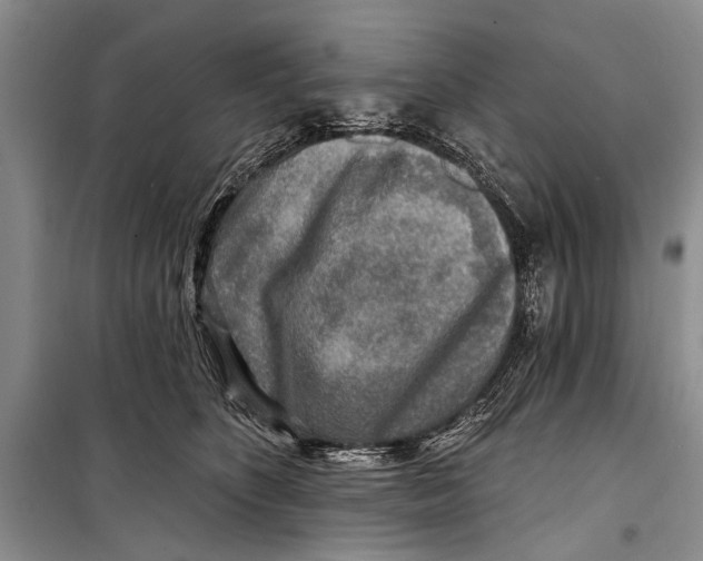 X0000098170516200805151119