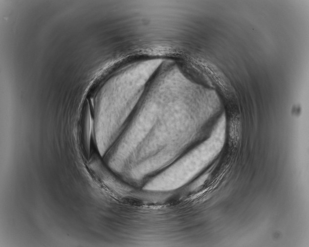 X0000098170540200805151119