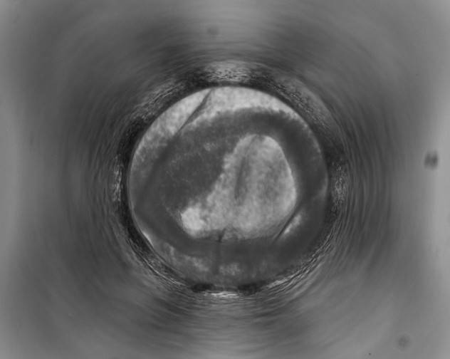 X0000098170551200805151119