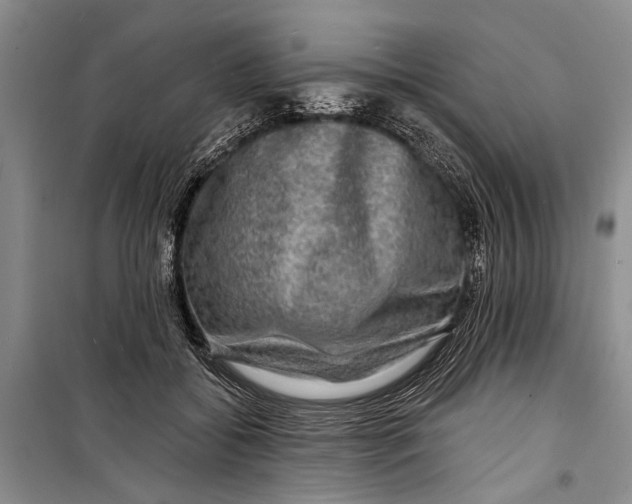 X0000098170556200805151119