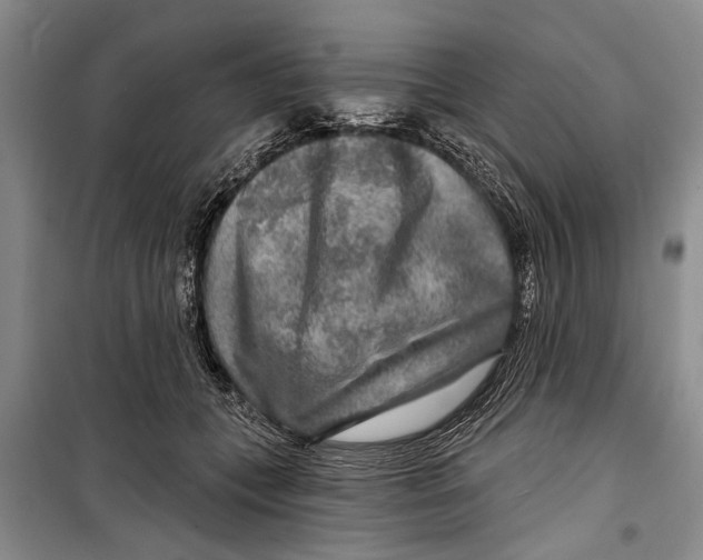 X0000098170559200805151119