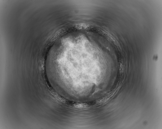 X0000098170561200805151119