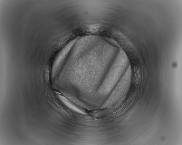 X0000098170562200805151119