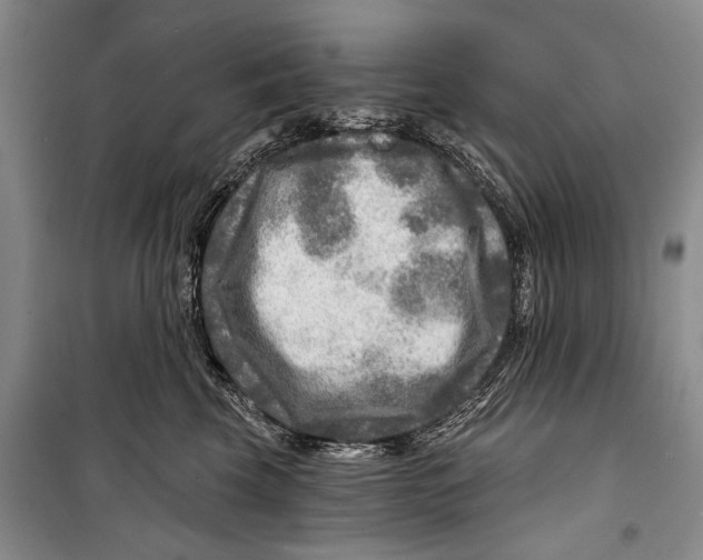 X0000098170569200805151119