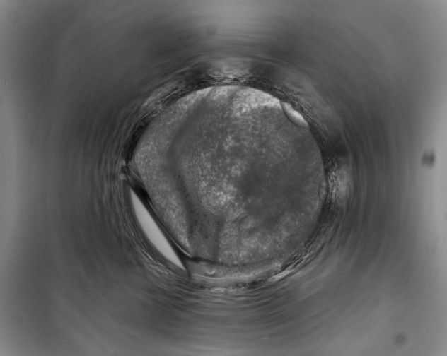 X0000098170570200805151119