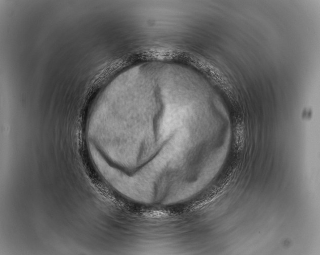 X0000098170594200805151118