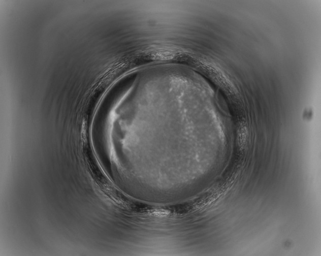 X0000098170598200805151118