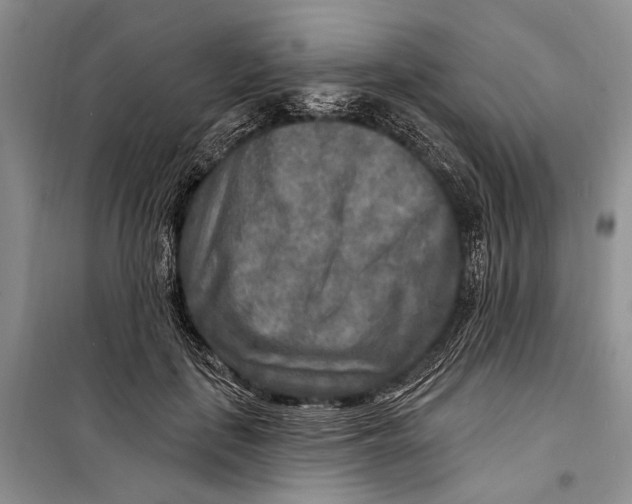 X0000098170651200805151118