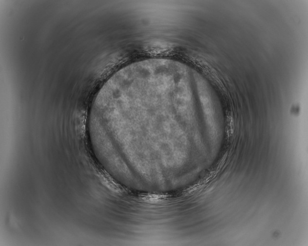 X0000098170664200805151118