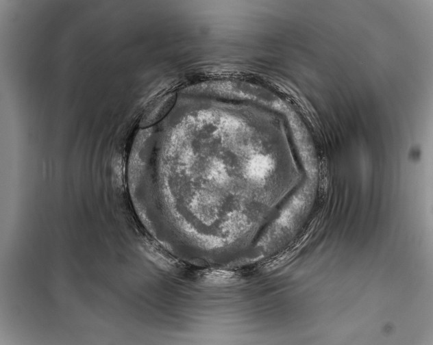 X0000098170669200805151118