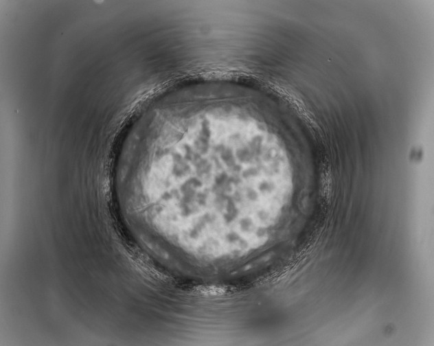 X0000098170687200805151117