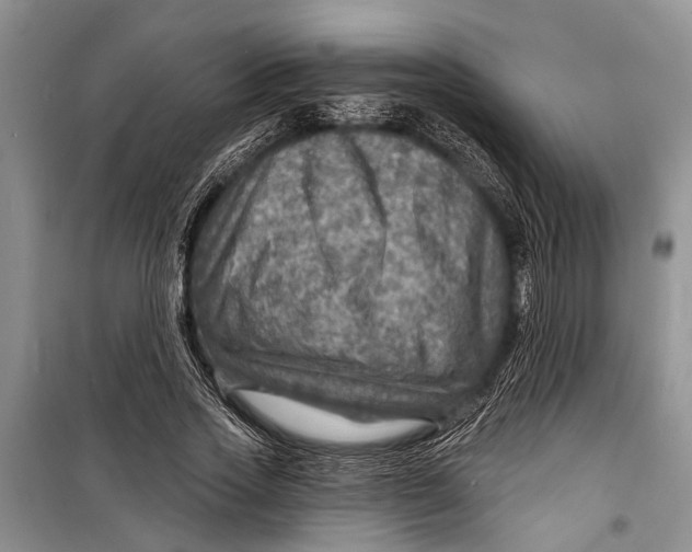 X0000098170733200805151116