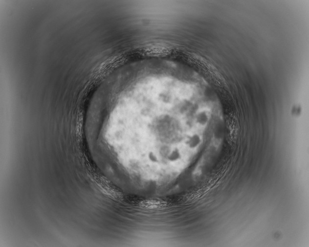 X0000098170745200805151116