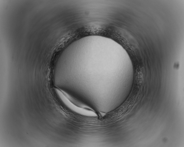 X0000098170750200805151116