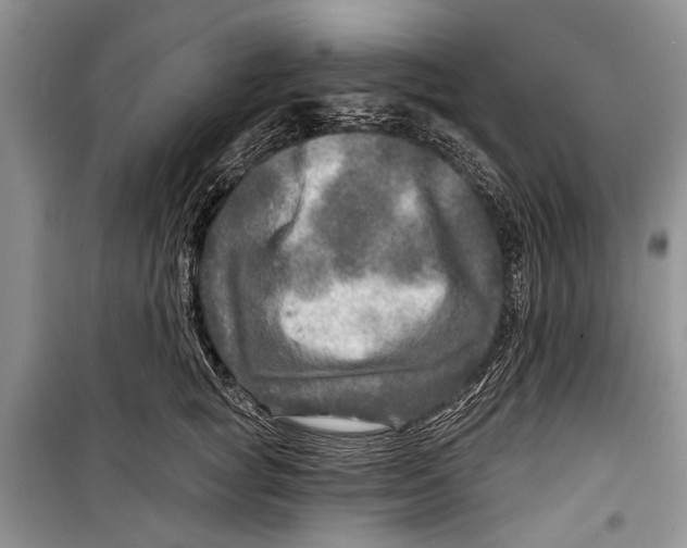 X0000098170757200805151116