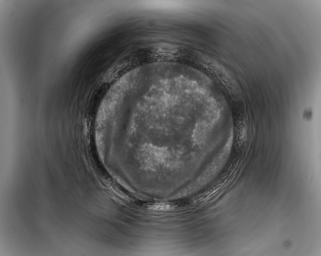 X0000098170759200805151116