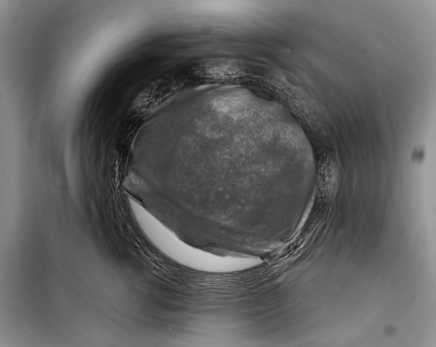 X0000098170762200805151116