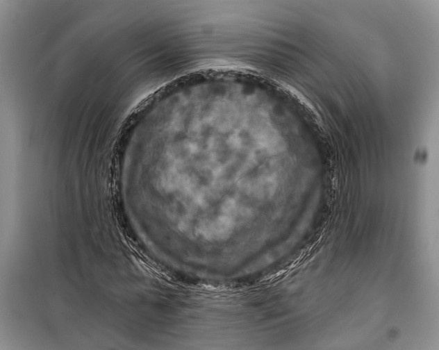 X0000098170775200805151116