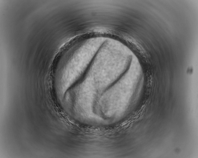 X0000098170776200805151116