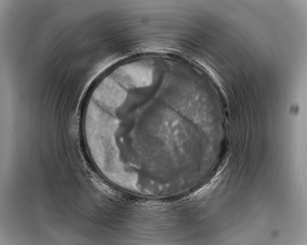 X0000098170779200805151116