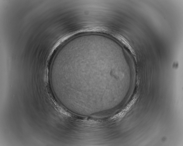 X0000098170781200805151115