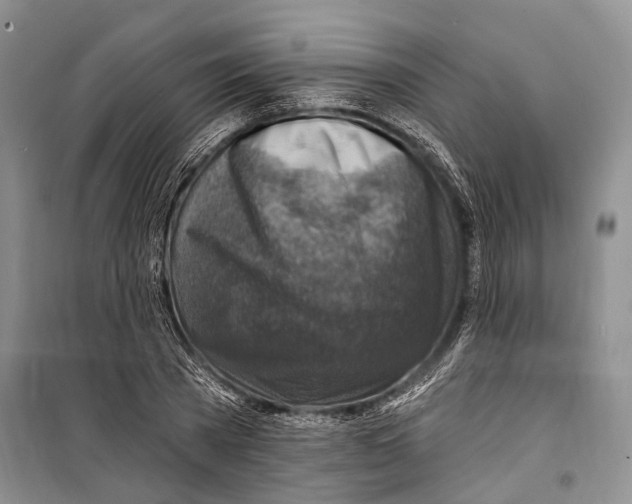 X0000098170785200805151115