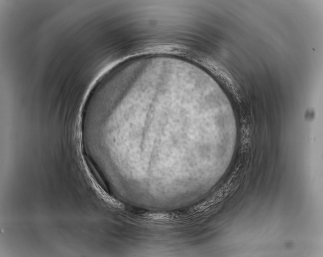 X0000098170792200805151115