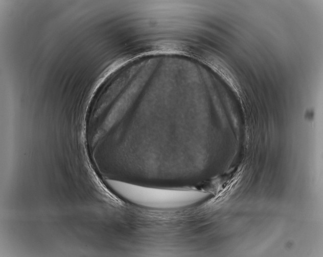 X0000098170797200805151115