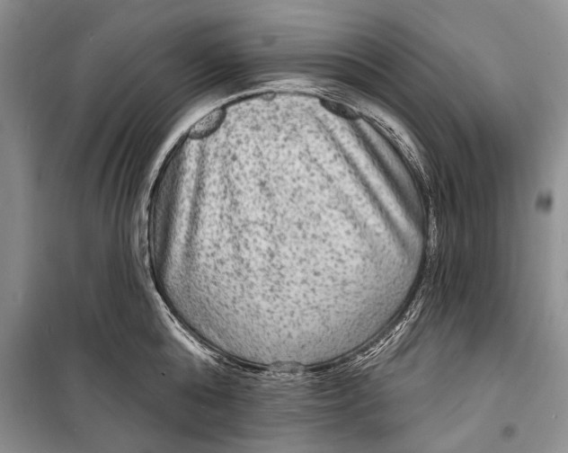 X0000098170808200805151115