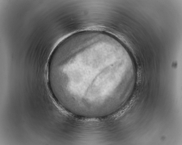 X0000098170838200805151115