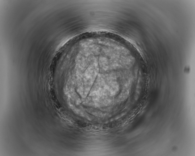 X0000098170871200805151114