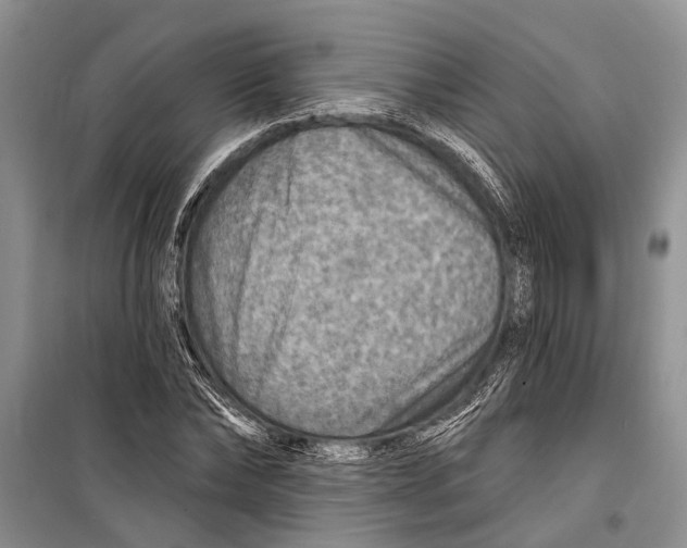 X0000098170878200805151114