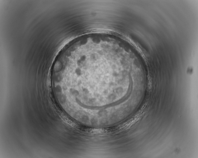 X0000098170883200805151114