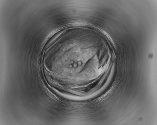 X0000098170930200805151113