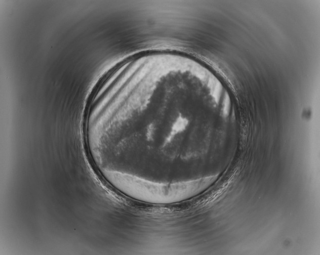 X0000098170943200805151113