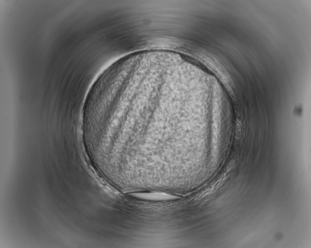 X0000098170948200805151113