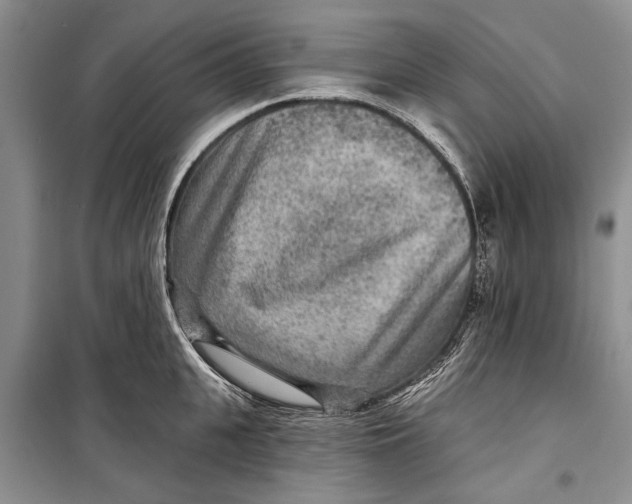 X0000098170951200805151113