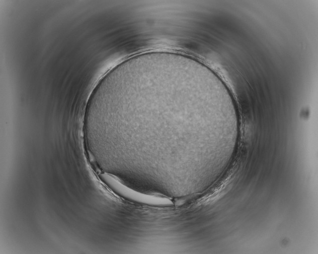 X0000098170954200805151113