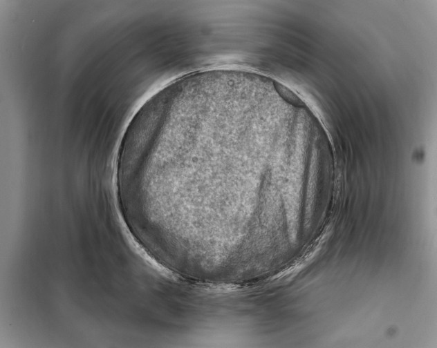 X0000098170957200805151113