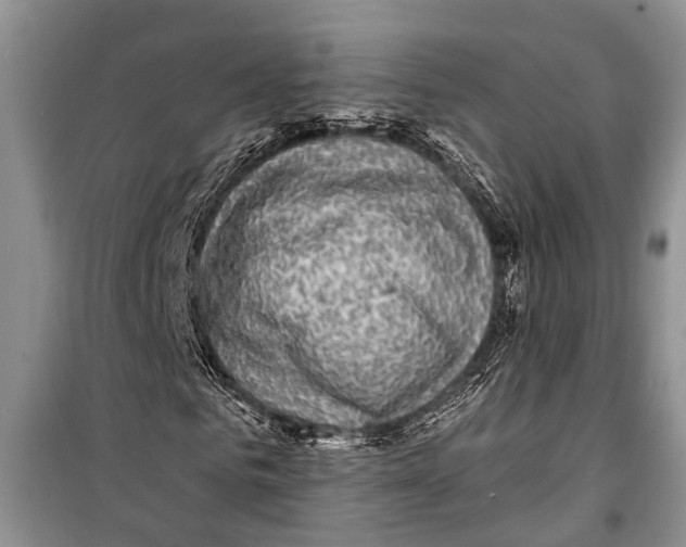 X0000098170961200805151113