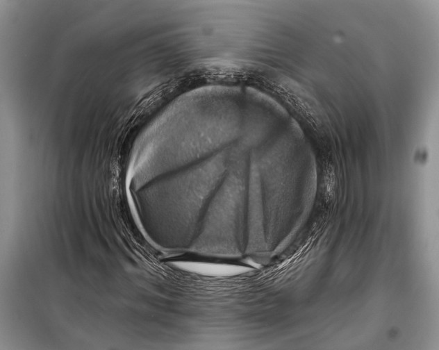 X0000098170964200805151113